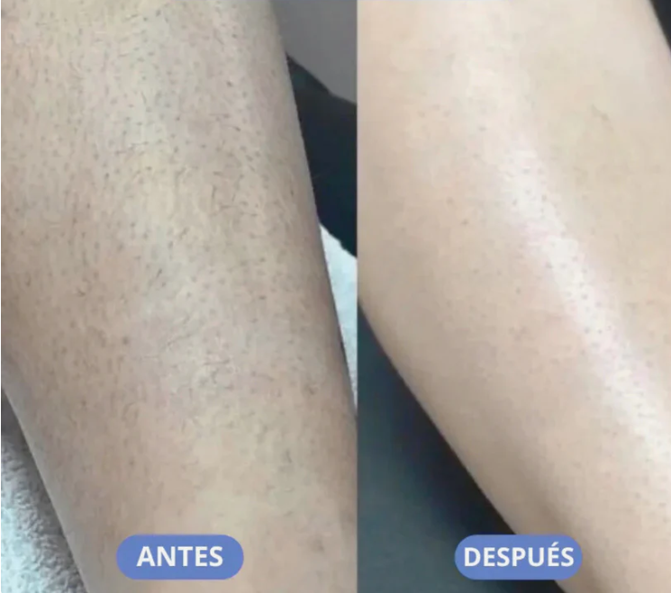 Cuidar de ti Nunca fue tan Fácil | Maquina Depiladora de Cuerpo Completo | Envío Gratis